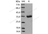 Recombinant Mouse CXADR/CAR Protein (His Tag)(Active)
