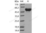 Recombinant Mouse Arylsulfatase A/ARSA Protein (His Tag)(Active)