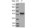 Recombinant Mouse Cathepsin L/CTSL Protein (aa 1-334, His Tag)