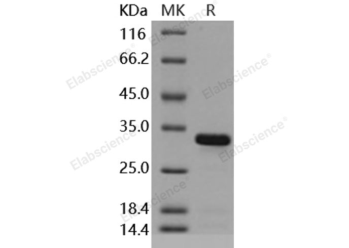 Recombinant Mouse BCL2L1/Bcl-XL Protein (aa 1-212, His Tag)(Active)