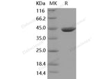 Recombinant Mouse ACY1/Aminoacylase-1 Protein (His Tag)(Active)