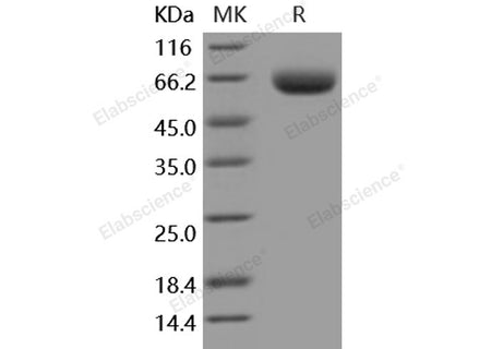 Recombinant Mouse BACE1/ASP2 Protein (His Tag)(Active)