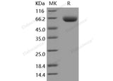 Recombinant Mouse BACE1/ASP2 Protein (His Tag)(Active)