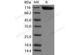 Recombinant Mouse ANPEP/CD13 Protein (His Tag)(Active)