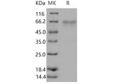 Recombinant Mouse HVEM/TNFRSF14 Protein (His & Fc Tag)(Active)