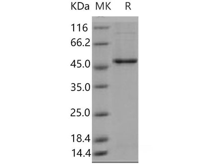 Recombinant Mouse GSK3B Protein (His Tag)(Active)
