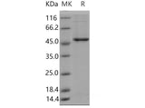 Recombinant Mouse GSK3B Protein (His Tag)(Active)