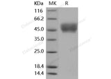 Recombinant Mouse CD64/FCGR1 Protein (His Tag)(Active)