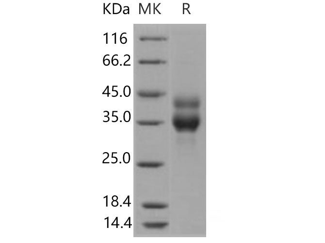 Recombinant Mouse Cathepsin B/CTSB Protein (His Tag)(Active)