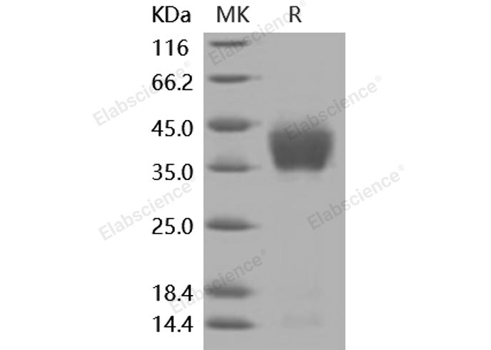 Recombinant Mouse ENPEP/Aminopeptidase A Protein (His Tag)(Active)