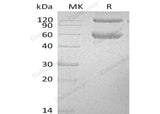Recombinant Mouse BMPRIA/ALK-3 Protein (His Tag)(Active)