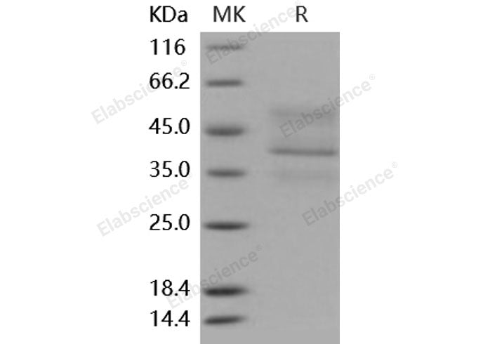 Recombinant Mouse TNFRSF17/BCMA Protein (His & Fc Tag)(Active)