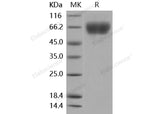 Recombinant Mouse FGFR3 Protein (His Tag)(Active)