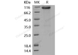 Recombinant Mouse FGFR3 Protein (His & Fc Tag)(Active)