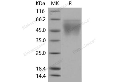 Recombinant Mouse CD86/B7-2 Protein (His Tag)(Active)