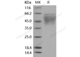 Recombinant Mouse CD86/B7-2 Protein (His Tag)(Active)