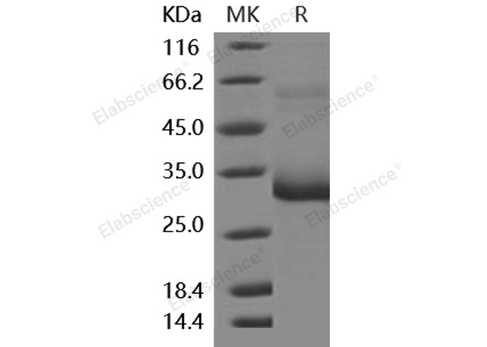 Recombinant Mouse MBL2/MBL/COLEC1 Protein (His Tag)