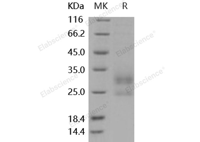 Recombinant Mouse MD1 Protein (His Tag)