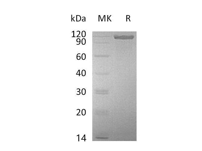 Recombinant Mouse ALCAM/CD166 Protein (Fc Tag) 