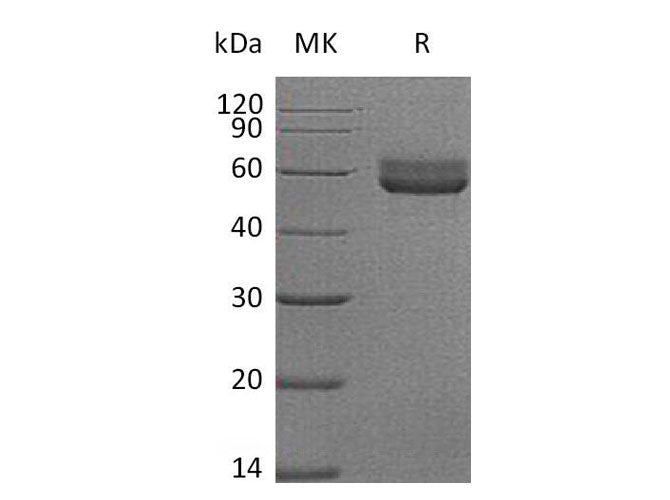 Recombinant Mouse HVEM/TNFRSF14 Protein (Fc Tag)(Active)