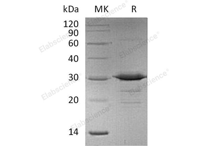 Recombinant Mouse Adiponectin/AdipoQ Protein (E.coli, His Tag)