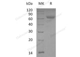 Recombinant Mouse ANGPTL4 Protein (Fc Tag)