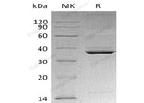 Recombinant Mouse Apolipoprotein E/ApoE Protein (His Tag)