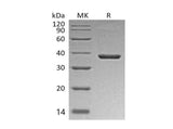 Recombinant Mouse B7-H3/CD276 Protein (His Tag) 
