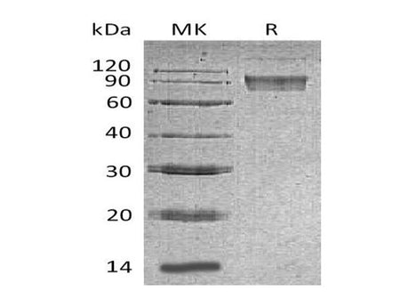Recombinant Mouse B7-H4/VTCN1 Protein (aa 25-256, Fc Tag)