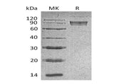 Recombinant Mouse B7-H4/VTCN1 Protein (aa 25-256, Fc Tag)