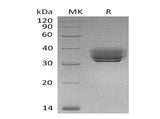 Recombinant Mouse Butyrophilin 1A1/BTN1A1 Protein (His Tag)