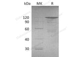 Recombinant Mouse Cadherin-3/CDH3 Protein (Fc Tag)