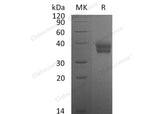 Recombinant Mouse Carbonic Anhydrase XII/CA12 Protein (His Tag)