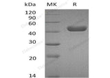 Recombinant Mouse Carbonic Anhydrase 14/Car14 Protein (His Tag)(Active)
