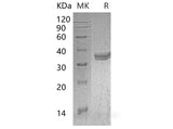 Recombinant Mouse Carbonic Anhydrase 4/CA4 Protein (aa 18-277, His Tag)
