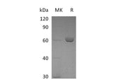 Recombinant Mouse Carboxylesterase 2E/CES2E Protein (His Tag)