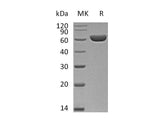 Recombinant Mouse Carboxylesterase 1D/SES1D Protein (His Tag)