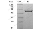 Recombinant Mouse Carbonic Anhydrase 4/CA4 Protein (aa 17-420, His Tag)