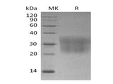 Recombinant Mouse CCL2/MCP-1 Protein (His Tag)