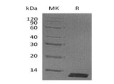 Recombinant Mouse CCL8/MCP-2 Protein (His Tag)