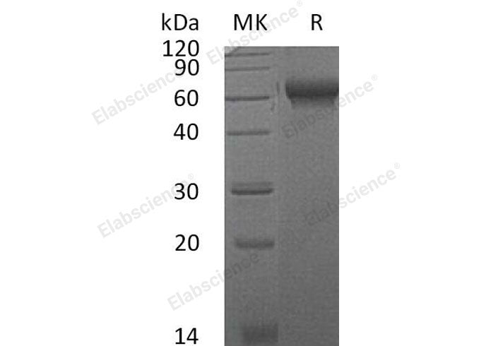 Recombinant Mouse CHL2/CHRDL2 Protein (His Tag) 