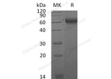 Recombinant Mouse CHL2/CHRDL2 Protein (His Tag) 