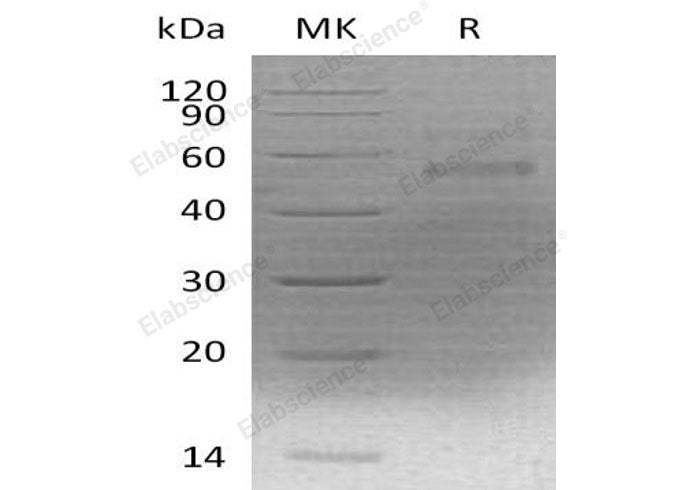 Recombinant Mouse Coagulation Factor X/F10 Protein (His Tag)