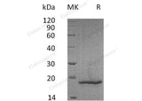 Recombinant Mouse COL18A1/Endostatin Protein (His Tag) 