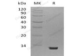 Recombinant Mouse Complement Component C5/C5 Protein