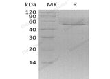Recombinant Mouse CX3CL1/Fractalkine Protein (His Tag)