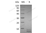 Recombinant Mouse CXCL1 Protein (His Tag) 