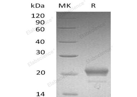 Recombinant Mouse CXCL15/Lungkine Protein (His Tag)