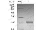Recombinant Mouse CXCL15/Lungkine Protein (His Tag)