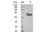 Recombinant Mouse CXCL16 Protein (His Tag)